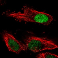 FBXL17 Antibody, Novus Biologicals 25 &mu;L, Unlabeled:Antibodies, Polyclonal